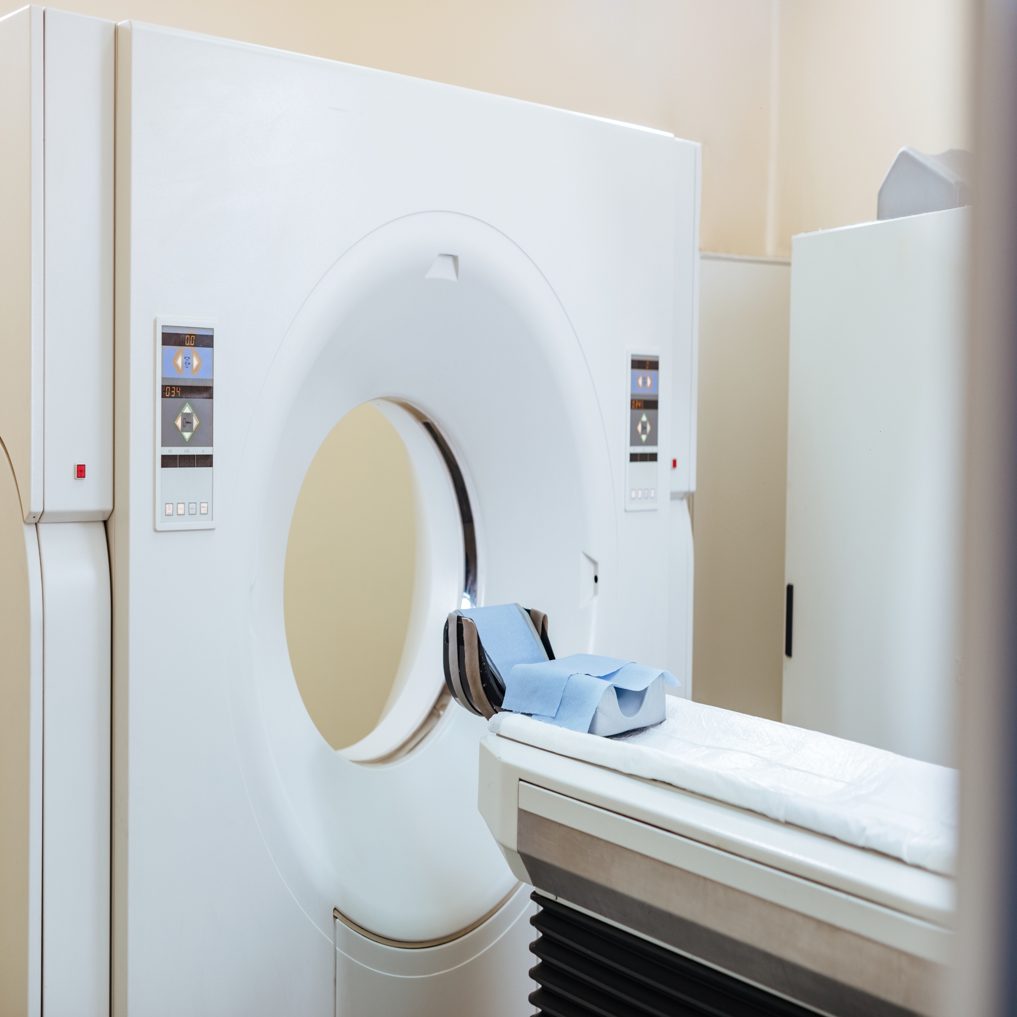 Digital X-Ray System